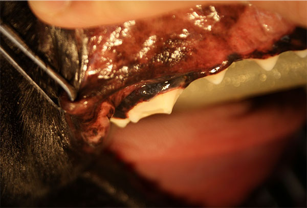 歯牙の破折