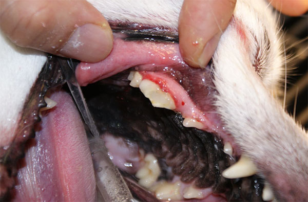 歯牙の破折による外歯瘻