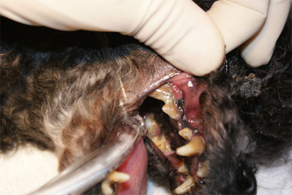 歯周病による外歯瘻